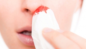 Почему течет кровь из носа?